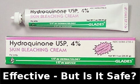 Hydroquinone - how long to work & is it safe